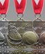 Picture of Basketball Star Medals